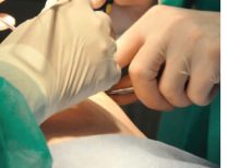 Sterile Latex Surgical Powdered Examination Gloves '7.0
